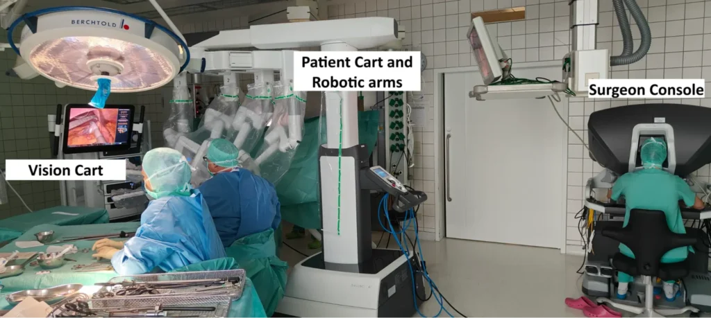 Robotic surgery setup with labeled parts