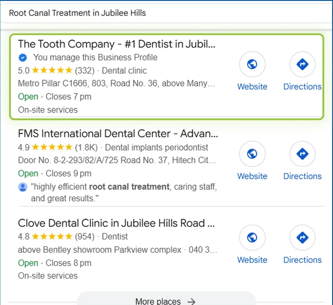 root canal treatment jubilee hills the tooth company