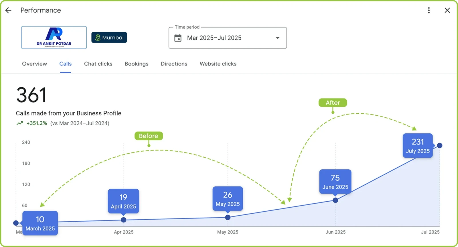 Google Business Profile performance for Dr Ankit Potdar: 361 calls, March to July 2025, monthly calls rising from 10 to 231