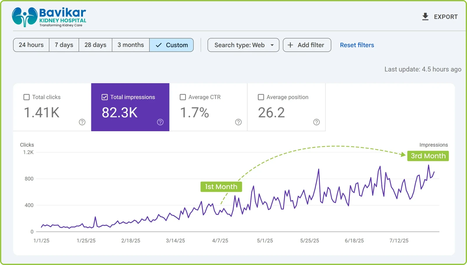 Google Search Console for Bavikar Kidney Hospital: 82.3K impressions and 1.41K clicks, January to July 2025